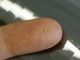 Mark Of The Beast Microchip Implants Are Here And Brain-Dead Sheep-People Are Jumping Right In To Get One